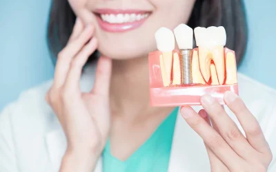 Implantologia Computer Guidata: Minima Invasività, Precisione e Guarigione Rapida