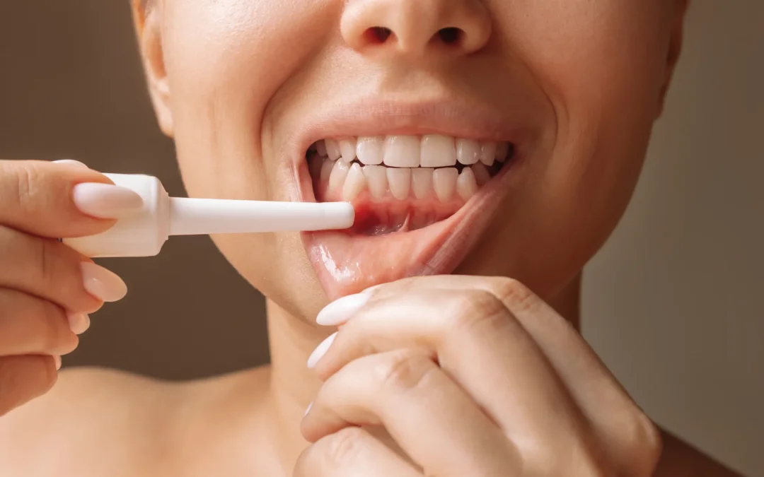 Parodontite: il nemico silenzioso del tuo sorriso – Diagnosi e cure a Giammoro Pace del Mela