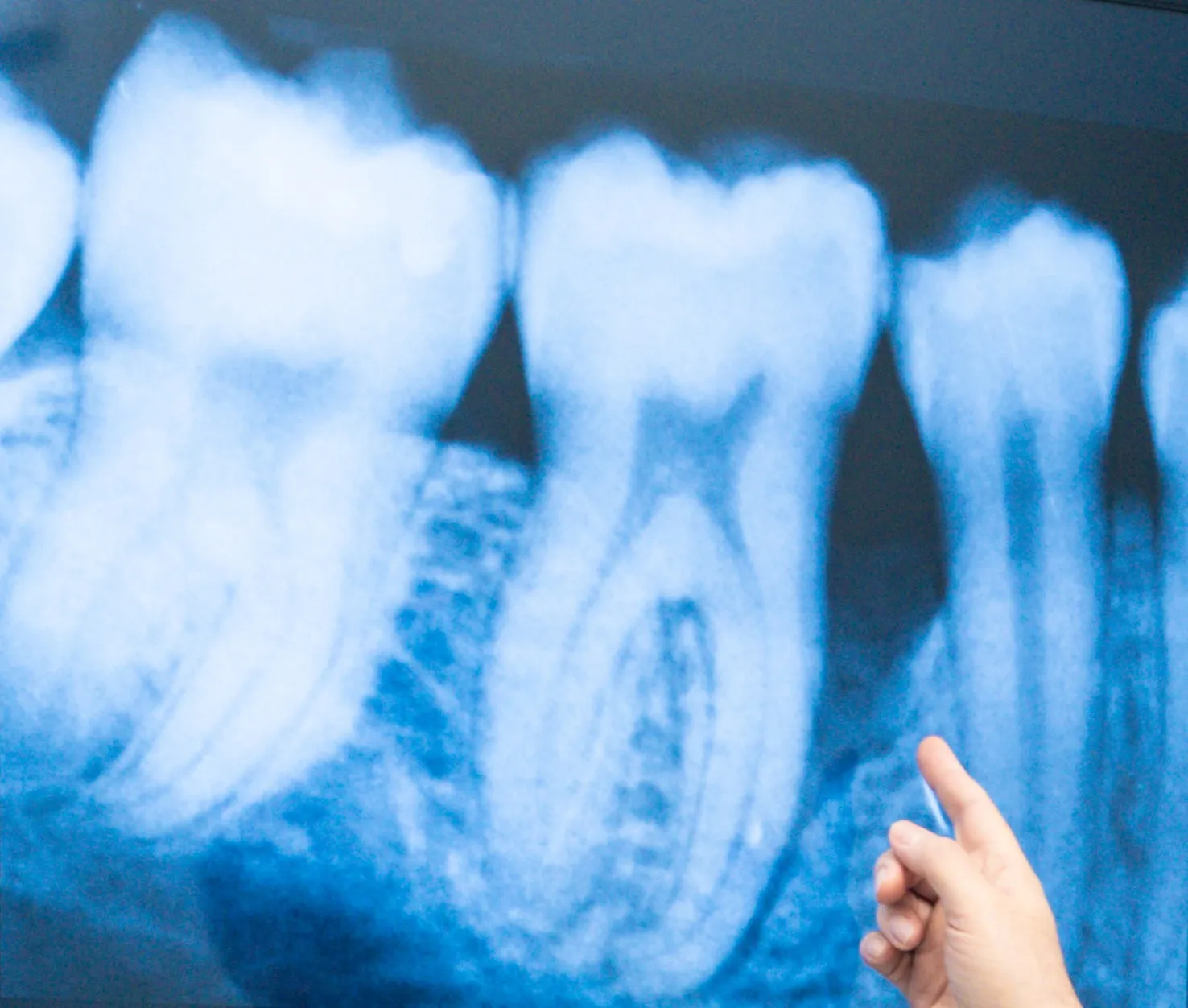 Studio Dentistico Belfiore - Dentista a Giammoro, Pace del Mela